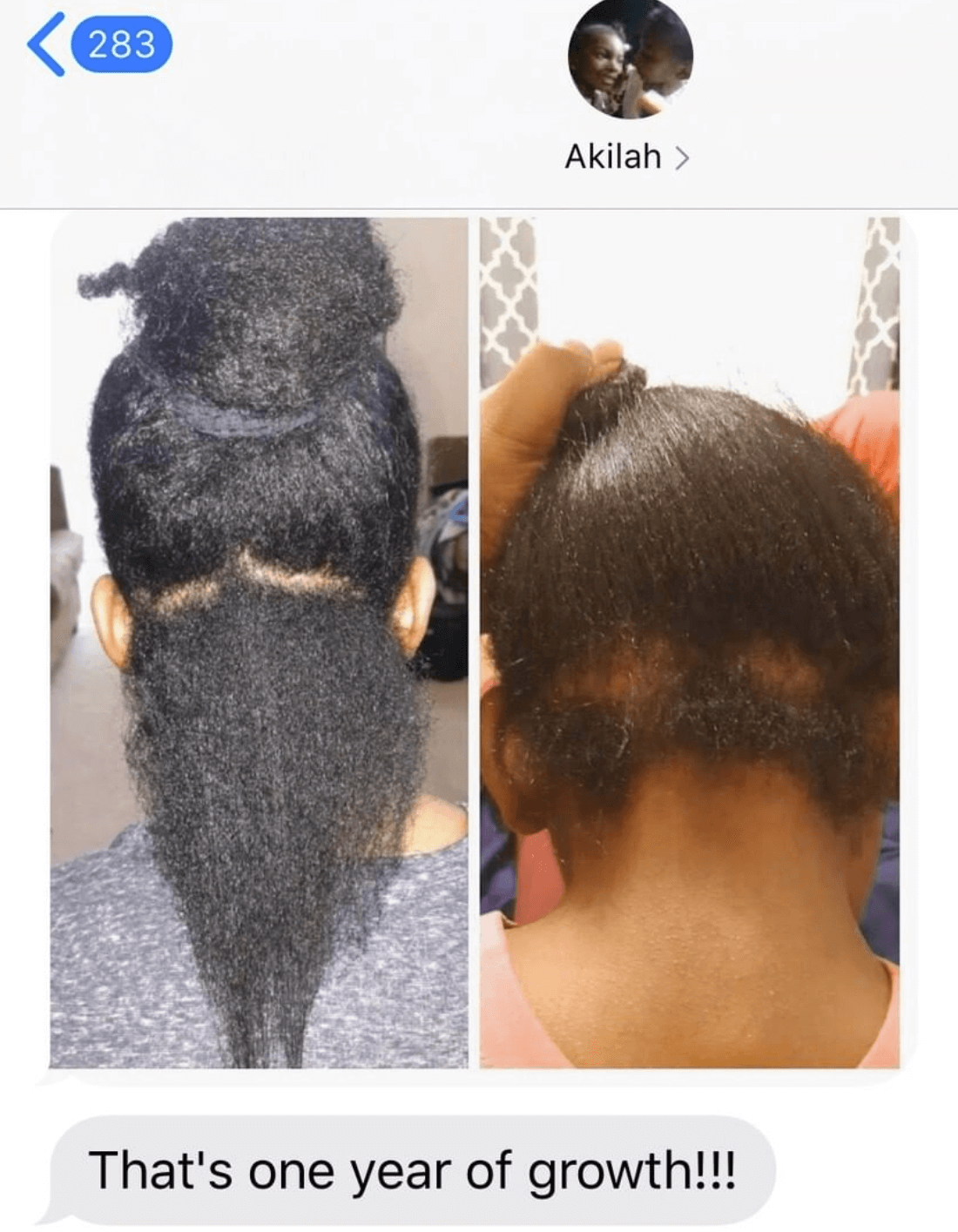 Spanish Almond Regrowth Oil – alternate view 2