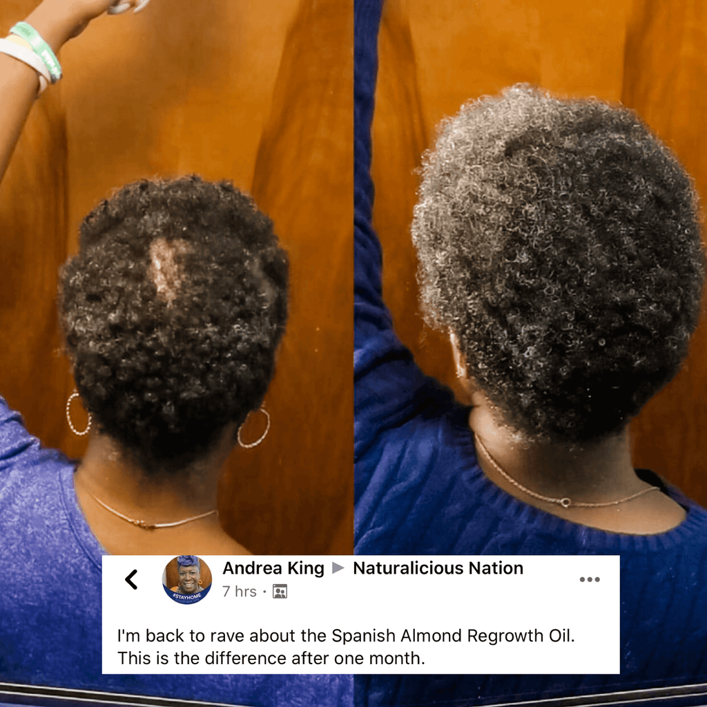 Spanish Almond Regrowth Oil – alternate view 4